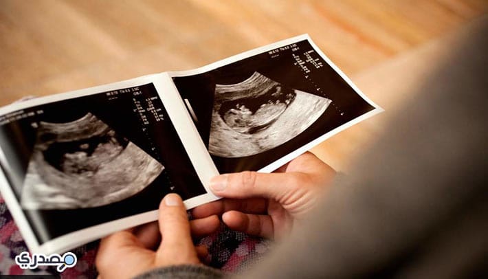 الحمل في الشهر الخامس ونوع الجنين
